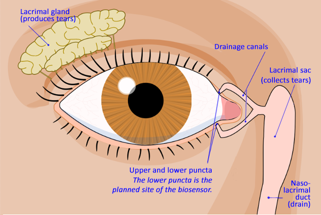 eye diagram