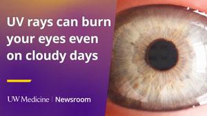 UV Rays story