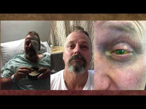 This is the image for UW Medicine Retina video